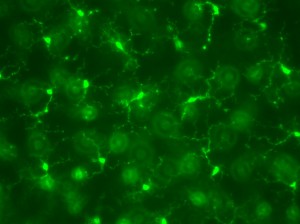 Microglia in the mouse retina.